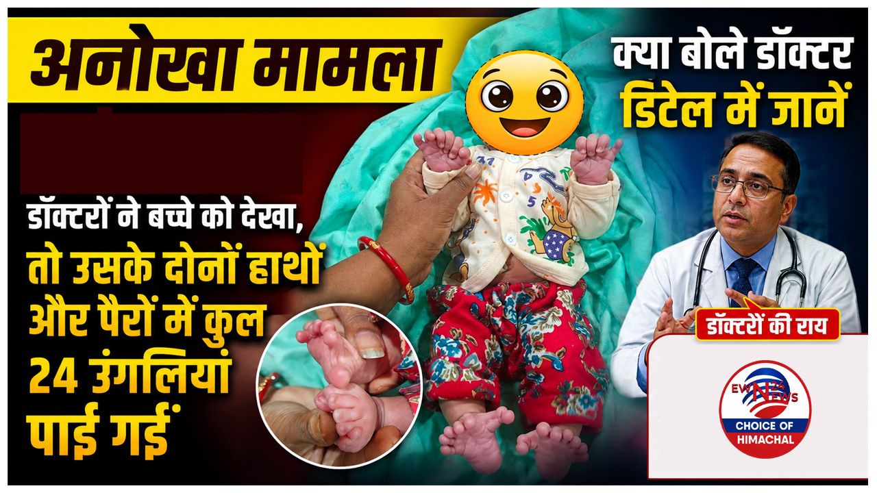 पालमपुर अस्पताल में 24 अंगुलियों के साथ जन्मा बच्चा, दोनों हाथों-पैरों में 6-6 अंगुली